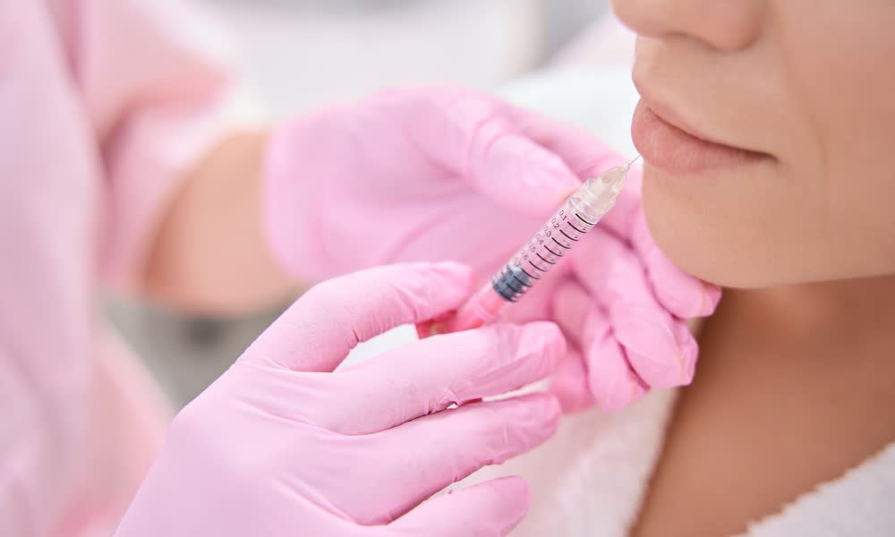 Dermal filler treatment